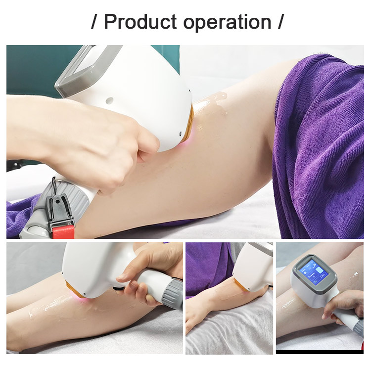 hot hair removal machine