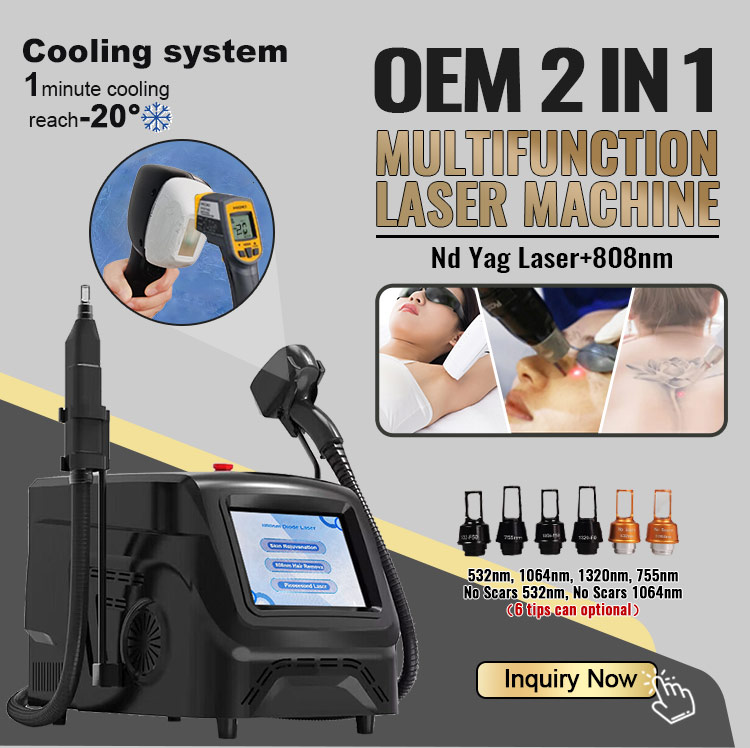 laser tattoo removal machine detail
