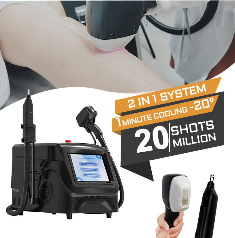laser tattoo removal machine detail