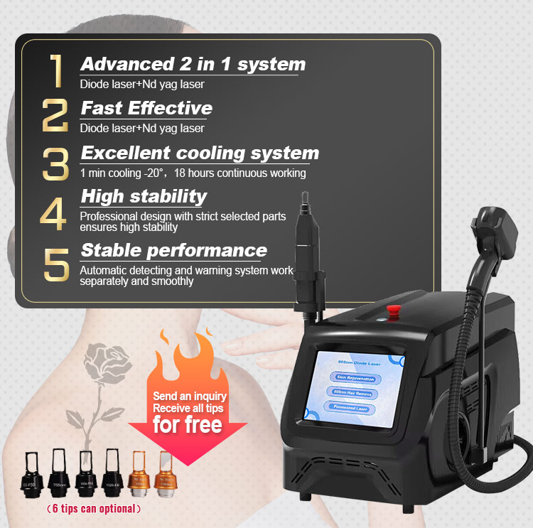 laser tattoo removal machine detail
