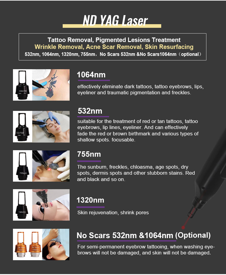 laser tattoo removal machine detail