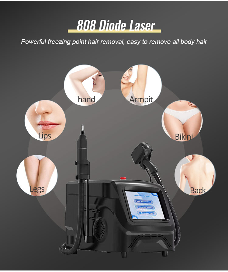 laser tattoo removal machine detail