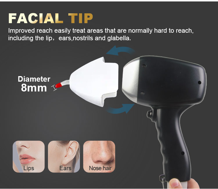 laser tattoo removal machine detail