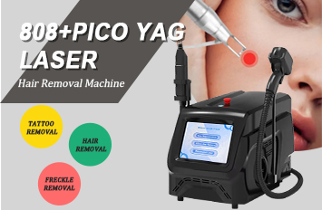 laser tattoo removal machine