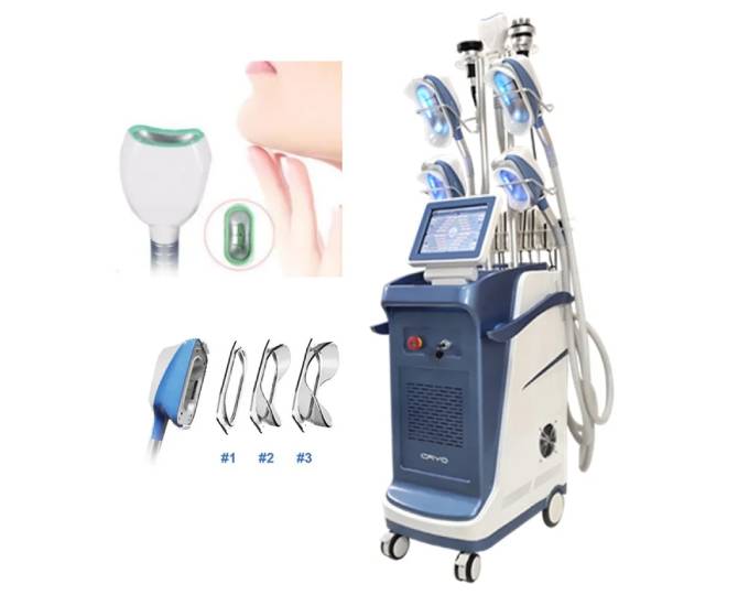 cryolipolysis 9