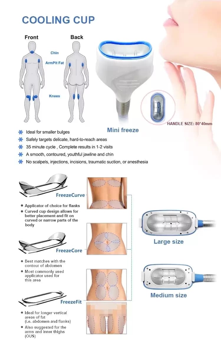 cryolipolysis 5
