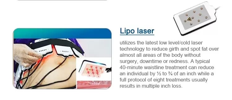 cryolipolysis 6