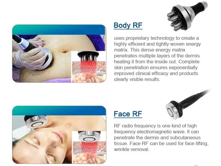 cryolipolysis 7