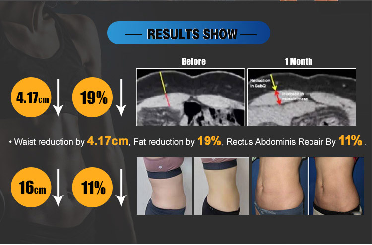 body muscles building ems machine