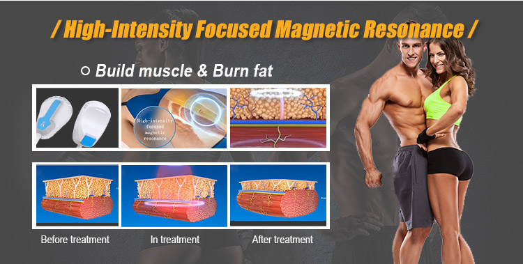 body muscles building ems machine