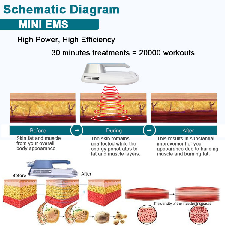 home emsculpt machine