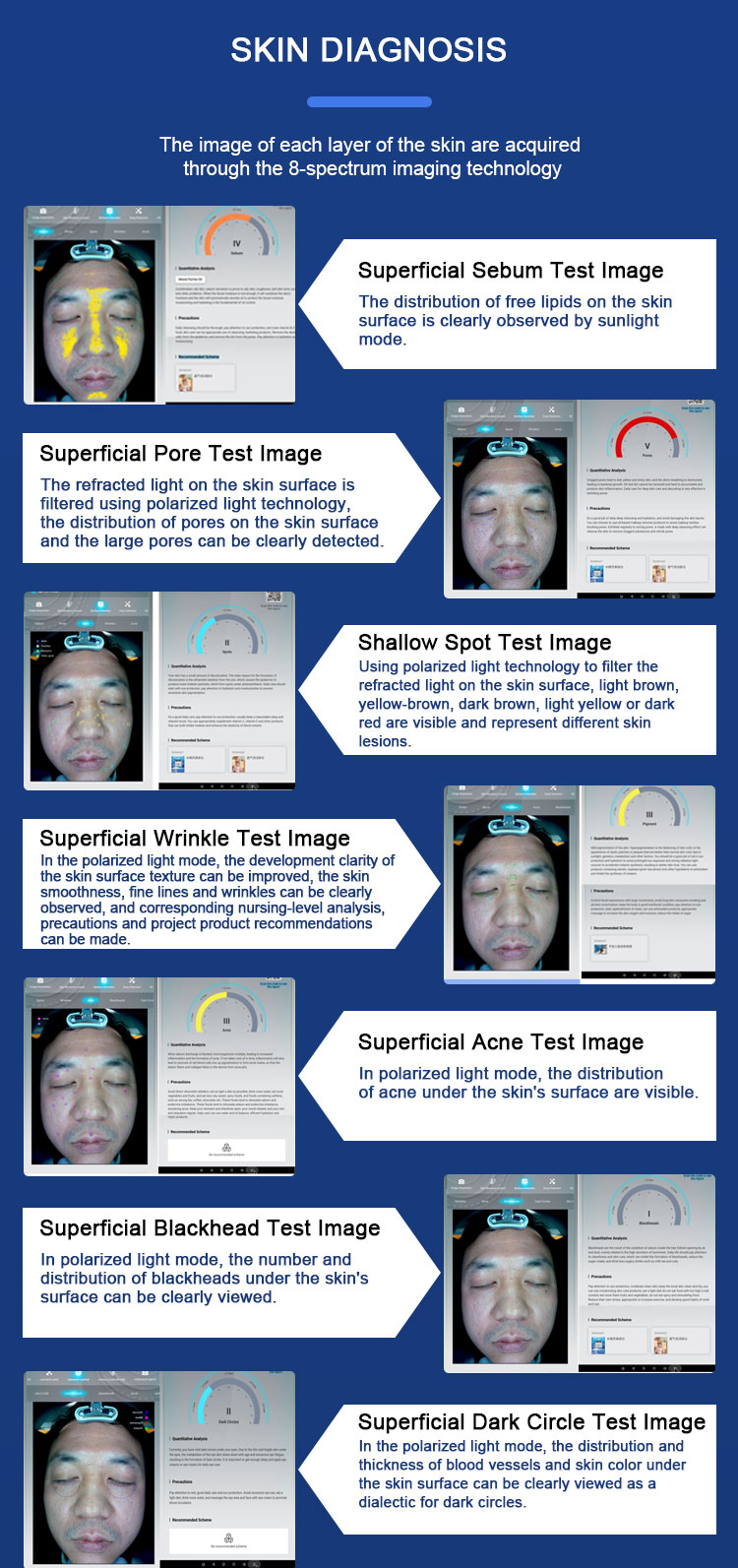 3d facial skin analyzer machine cost
