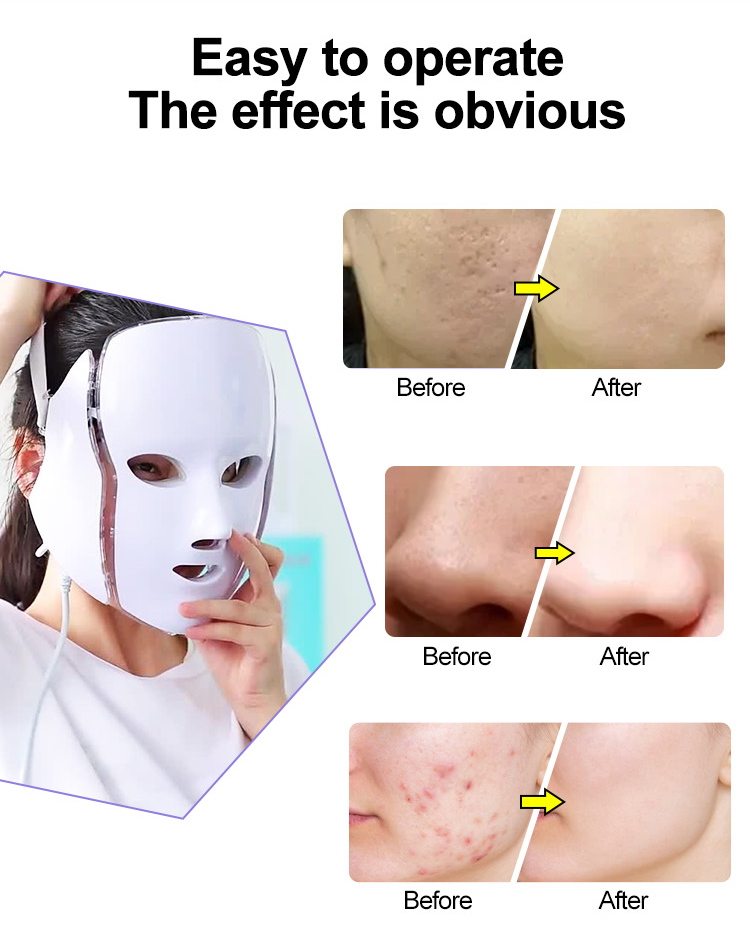7 color led face mask price