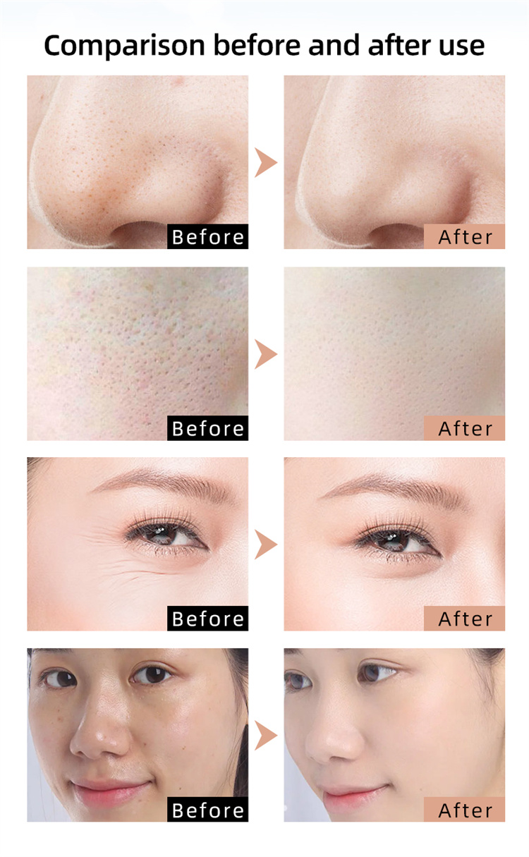 professional led light therapy mask benefits