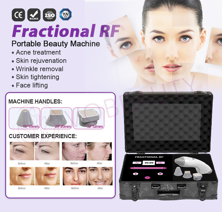 fractional rf machine for home use