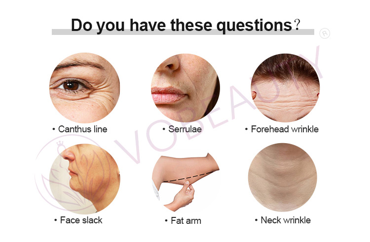 rf skin beauty device
