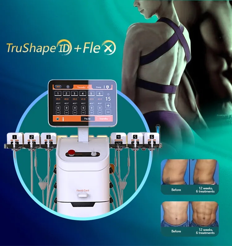 Trusculpt Flex machine
