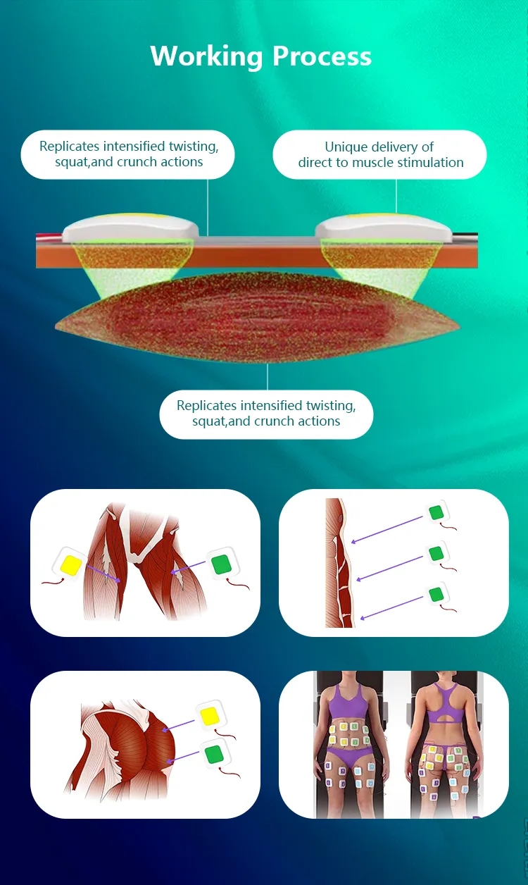 Trusculpt Flex machine