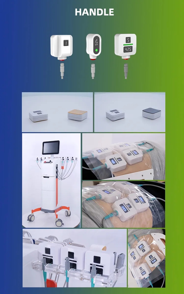 Trusculpt Flex machine