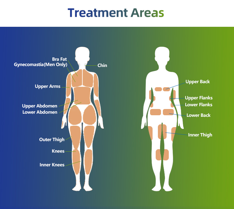trusculpt id treatment