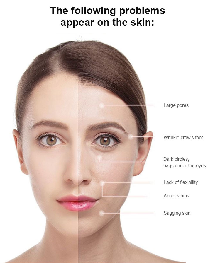 rf fractional microneedling price