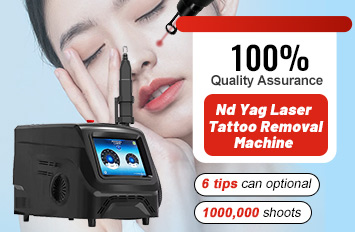 nd yag laser machine