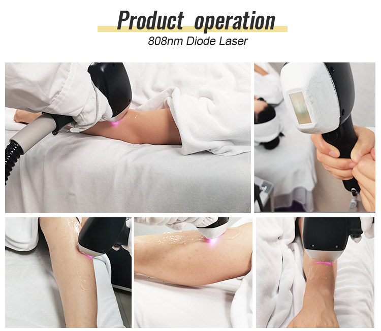 nd yag laser device