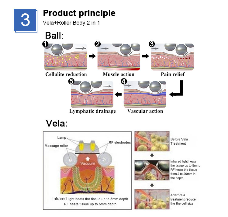 cavitation vacuum device