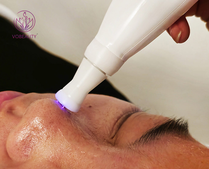 Ozone Plasma Pen Skin Care Machine