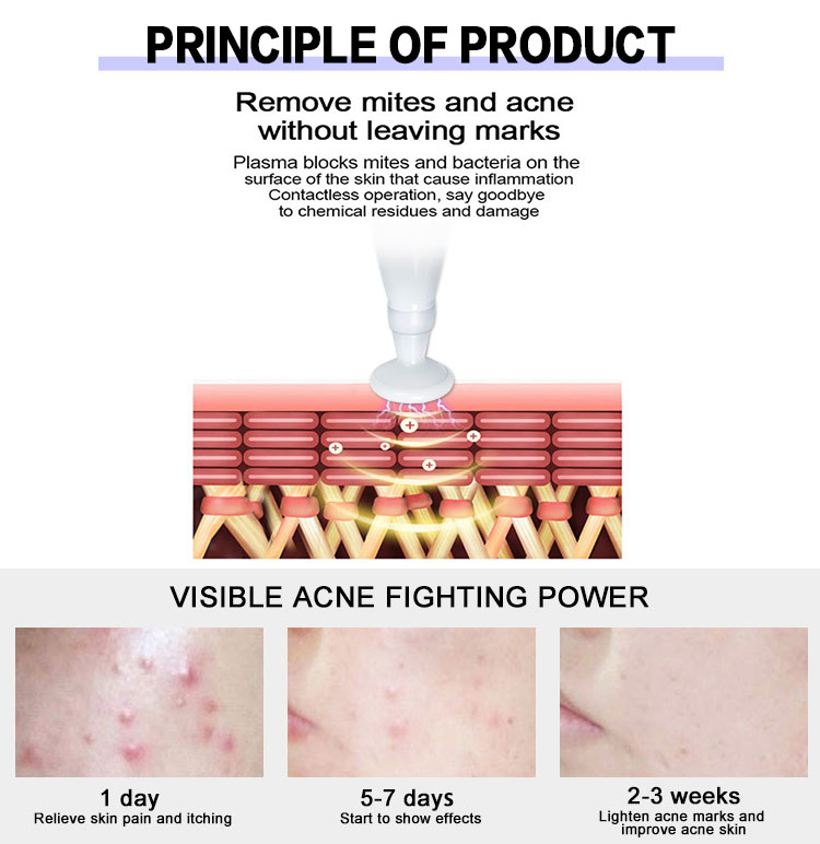 Portable ozone plasma pen machine