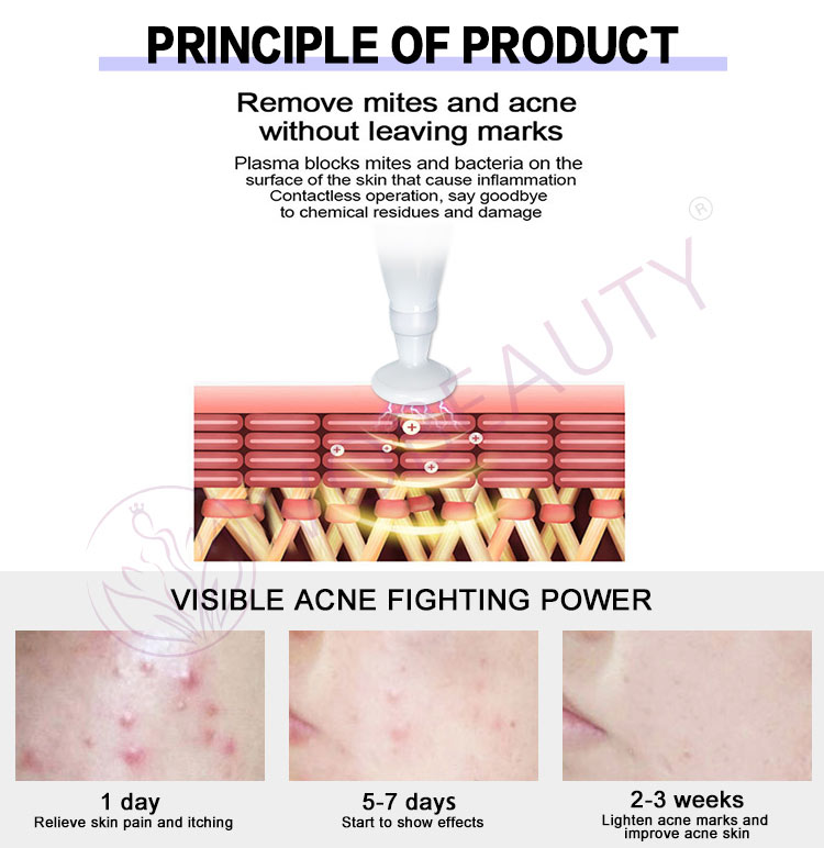 Warm Plasma Jet Skin Rejuvenation