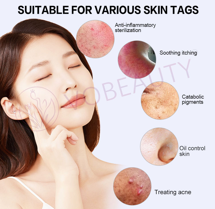 Warm Plasma Jet Skin Rejuvenation
