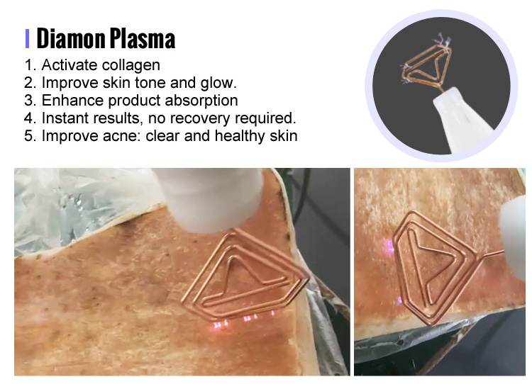 9 in 1 warm  cold plasma