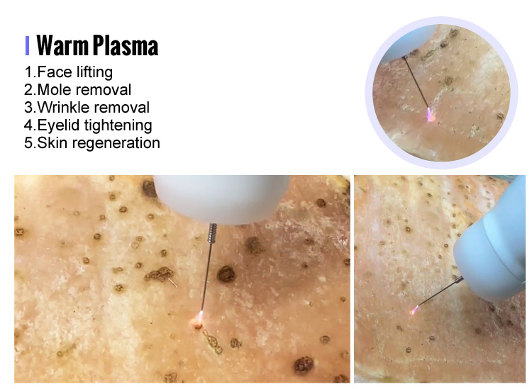 9 in 1 warm  cold plasma
